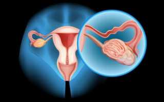 Классификация карциномы яичника и возможные пути терапии