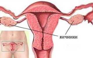 Что представляют собой гипоэхогенные образования в яичнике