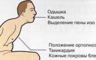 Алгоритм неотложной помощи при приступе бронхиальной астмы