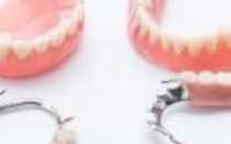 Протезирование после удаления зубов: через какое время можно ставить протез