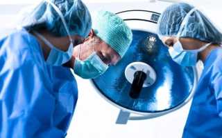 Тонкости проведения оофорэктомии