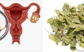 Лечение поликистоза яичников боровой маткой