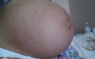 40 неделя беременности грудь болит