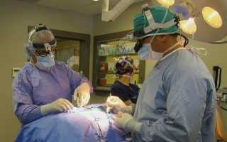 Причины образования спаек и способы их лечения