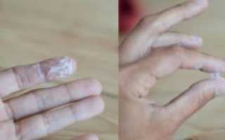 Выделения белые при зачатии