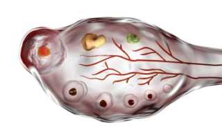 Гормоны и СПКЯ