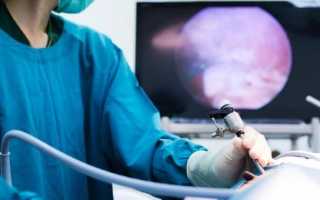 Для чего проводят лапароскопическую диагностику яичников и матки