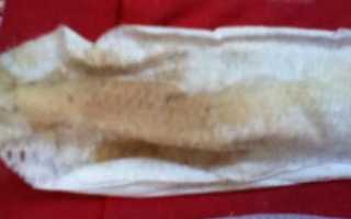 После задержки кровянистые выделения