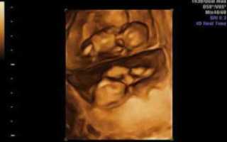 23 неделя беременности двойней