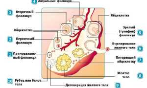 Причины появления у женщины желтого тела в левом яичнике