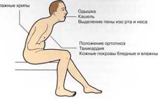 Первые признаки бронхиальной астмы