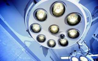 Каковы последствия удаления матки и яичников у женщины после 50 лет