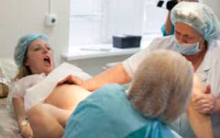 Сложные роды это какие