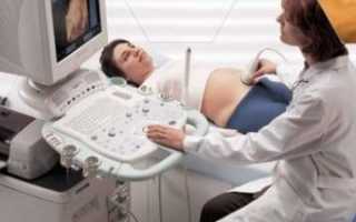 Чувство жжения в яичниках у женщины