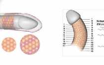 Удаление члена: причины, виды операций и возможные осложнения