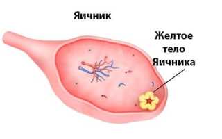 Причины образования жёлтого тела в правом яичнике