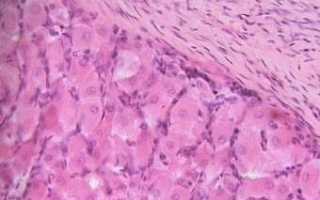 Причины появления гипертекоза яичников