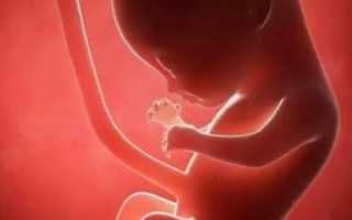 Опасность развития многокамерного образования яичника