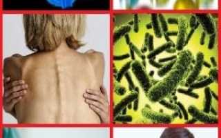 Симптомы и методика лечения гипофункции яичников