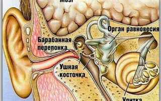 Лечение отита у взрослых в домашних условиях. Воспаление наружного, среднего и внутреннего уха