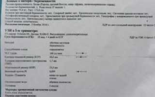 2 скрининг узи при беременности сроки проведения узи