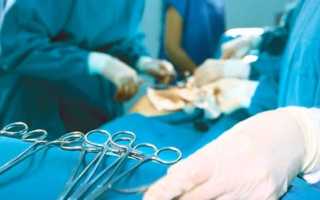 Особенности проведения овариэктомии