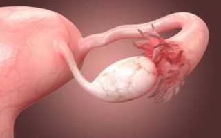 Как правильно рассчитывается объём яичников у женщины