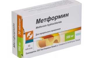 Лечение поликистоза яичников у женщин метформином