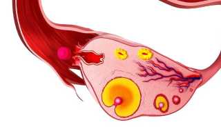 Наличие кисты желтого тела яичника у женщины и пути её лечения
