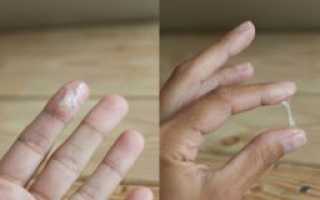 Выделения как белок до или после овуляции