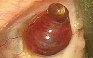 Для чего делают насечки на яичниках