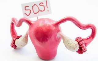 Атрофия женских яичников как причина бесплодия