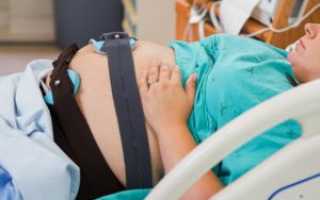 39 неделя беременности как ускорить