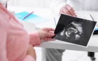 Проведение процедуры ЭКО до и после лапароскопии