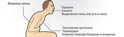 Признаки бронхиальной астмы