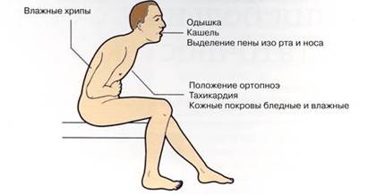 Первые симптомы бронхиальной астмы