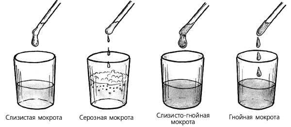 виды мокроты при ба