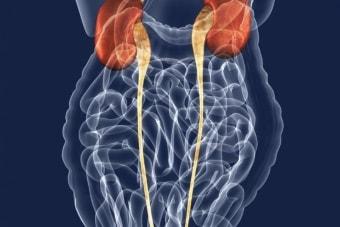 Появление андрогенитального синдрома