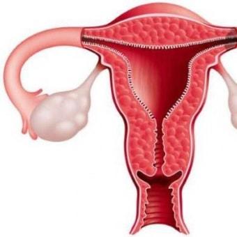 Зачатие с удалённым яичником