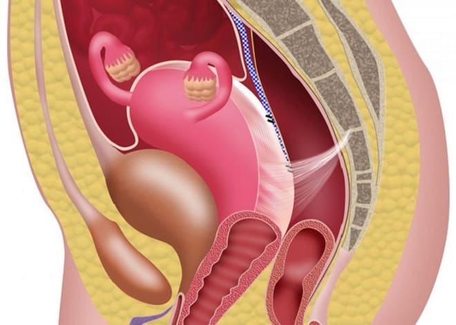 Инволюция матки