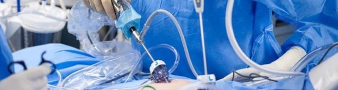 Диагностическая лапароскопия при кисте во время беременности