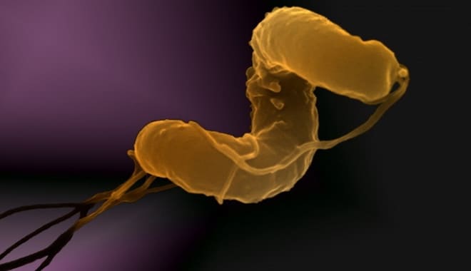 Инфекция проникает внутрь яичника