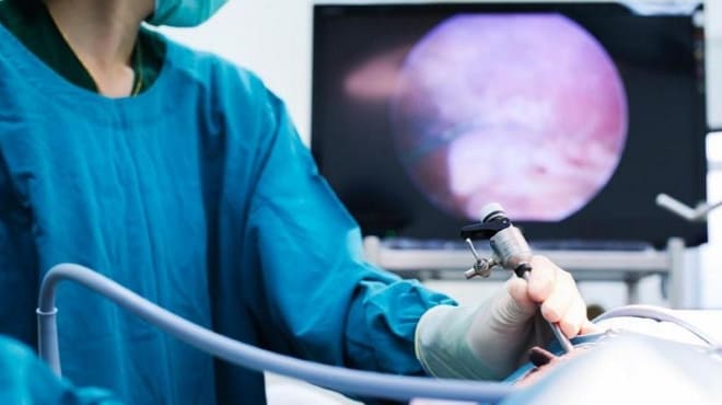 Диагностическая лапароскопия