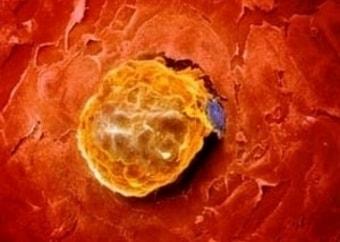 Жёлтое тело яичника у беременной девушки