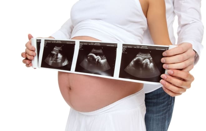 Как выглядит киста жёлтого тела при беременности