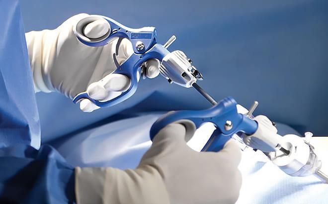 Проведение лапароскопической цистэктомии