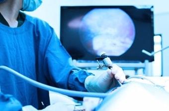 Резекция яичника лапароскопическим способом