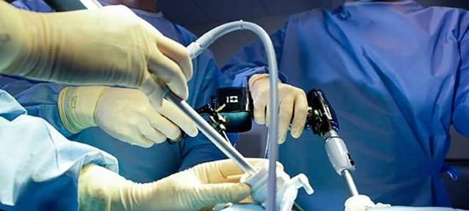 Методика проведения лапароскопии яичников и матки после 50 лет