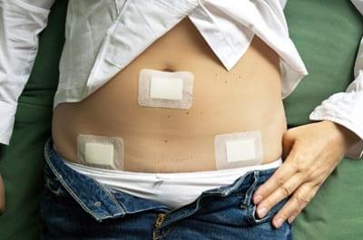 Антисептические салфетки на швы после декортикации