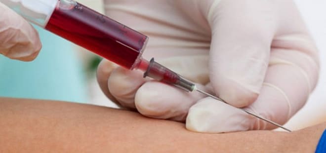 Анализ на АМГ в крови